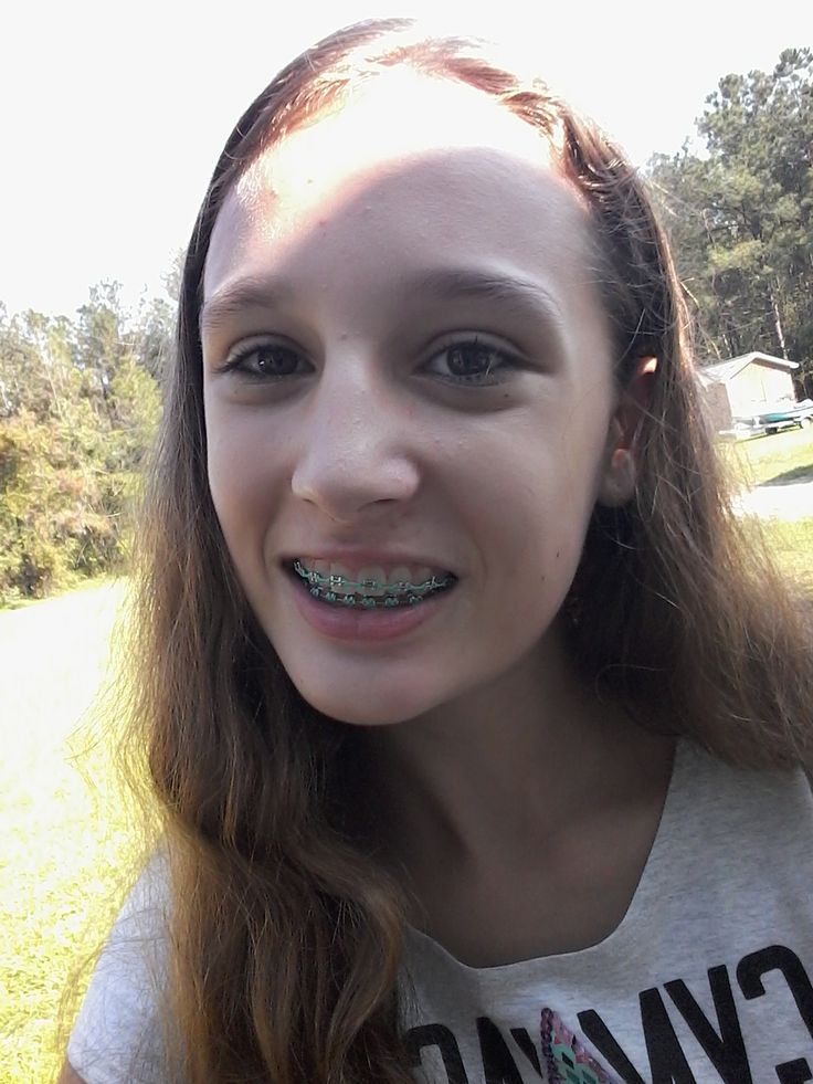 cum on braces comp - lesbian sex 101 bindage tube