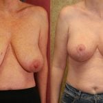 bablu dubey recommends saggy milf boobs pic