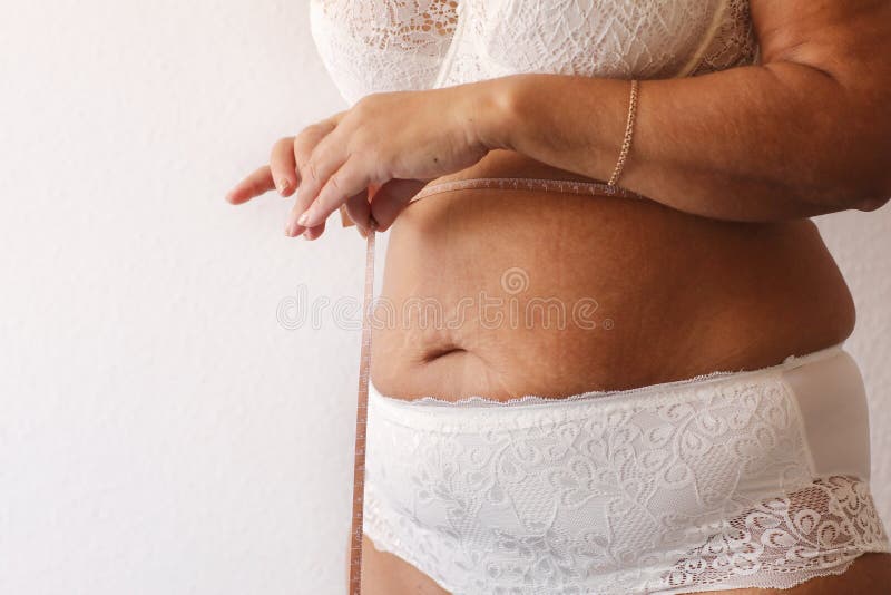 catherine voon recommends naked obese woman pic