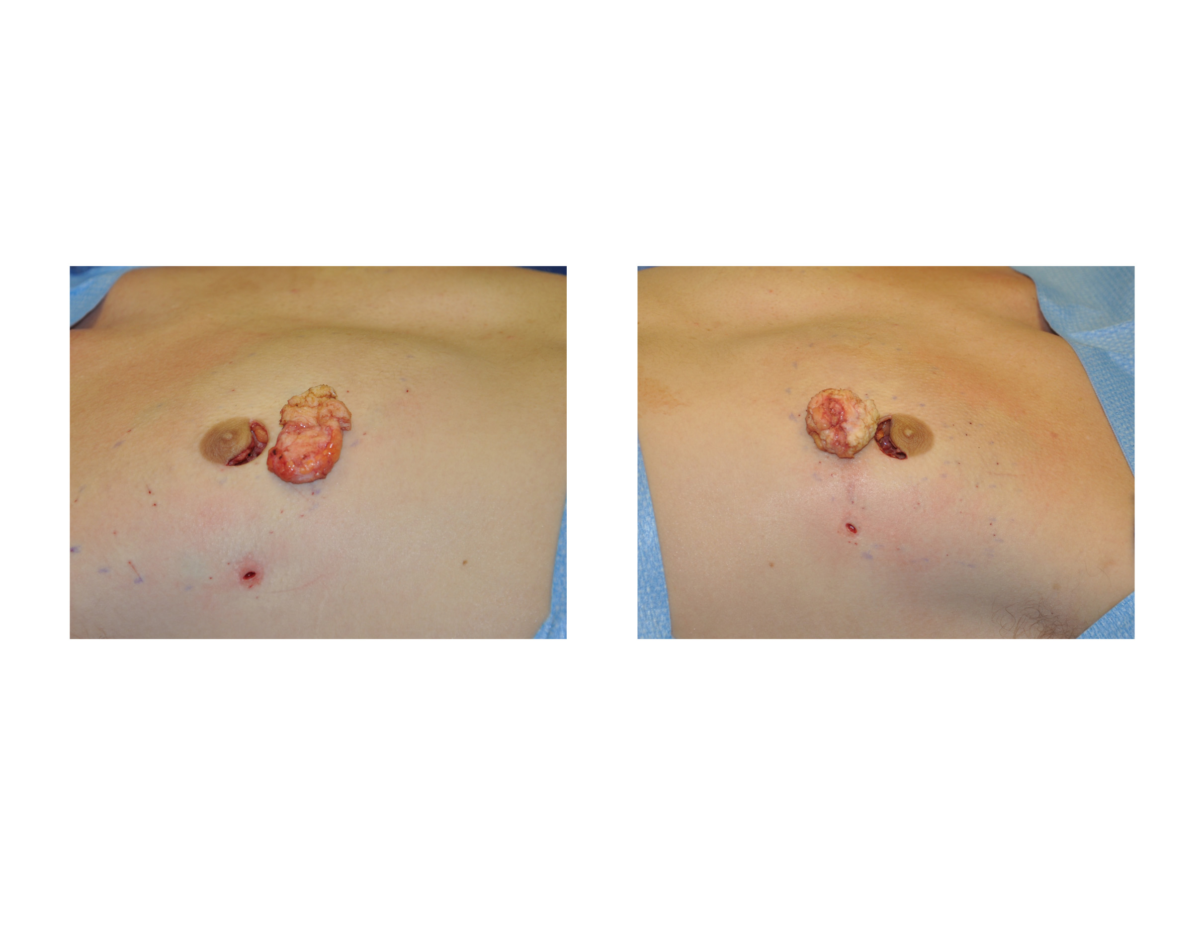 Small Puffy Nipple milf shared crystal whaley recommends Small Puffy Nipple
