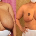 beverlyn bautista like big natural boob milf photo bidhan mahato recommends big natural boob milf pic