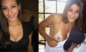 braces and big tits - glory hole lulu penic massage