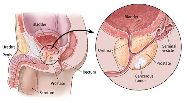 daniel mcgoldrick recommends Prostate Sex Stories