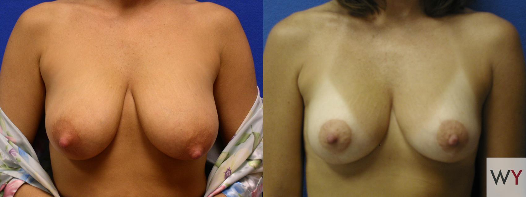 Best of Little perky titties