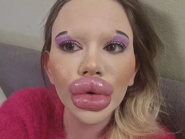 fake lips porn anderson lovell fake lips porn