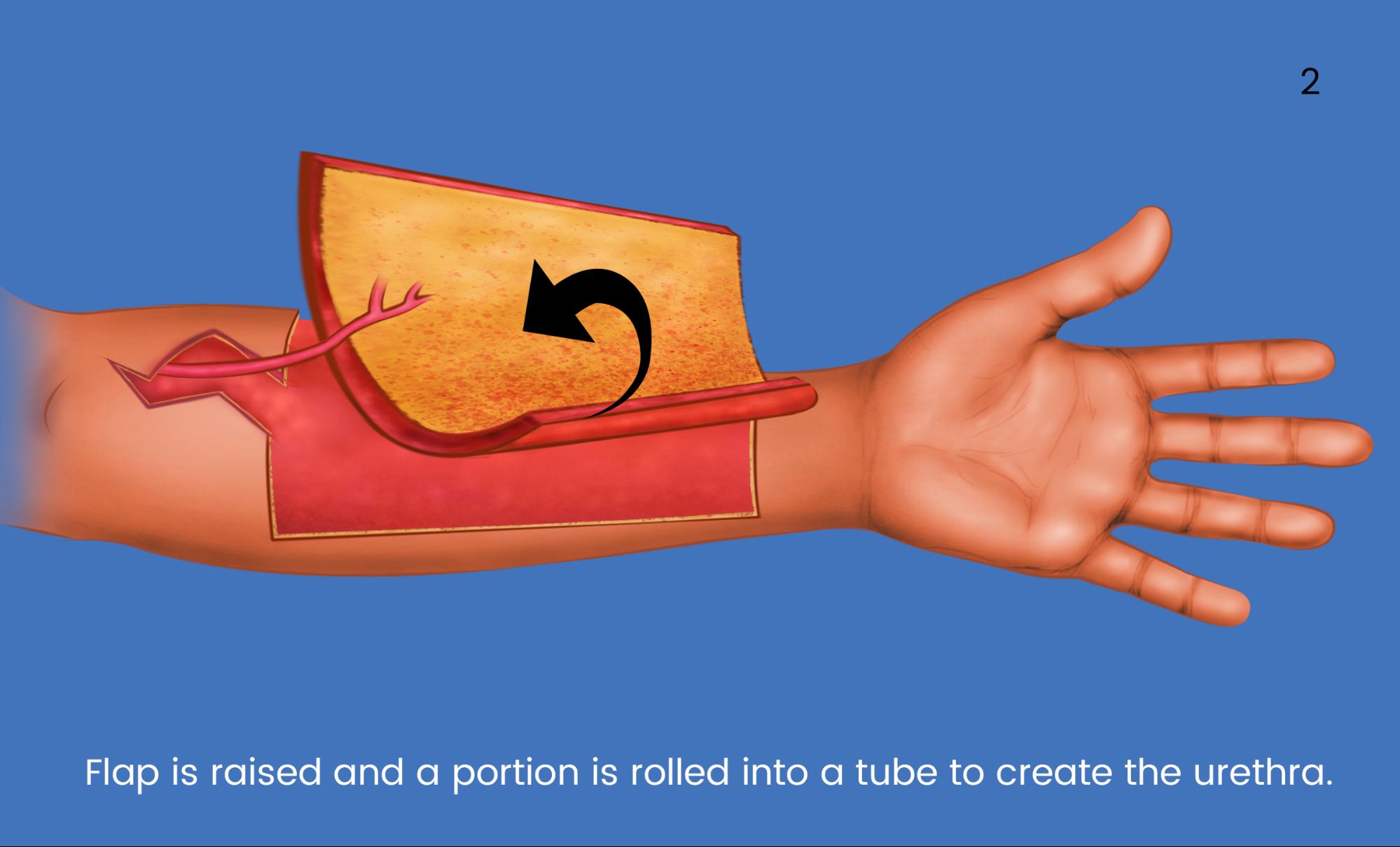 ayman samaan recommends finger in urethra pic