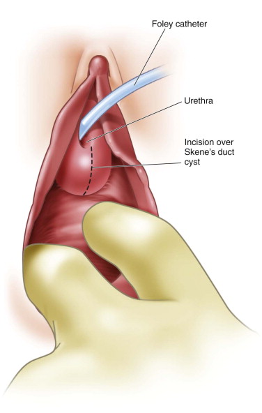 analyn abdon like finger in urethra photo al touchette recommends finger in urethra pic