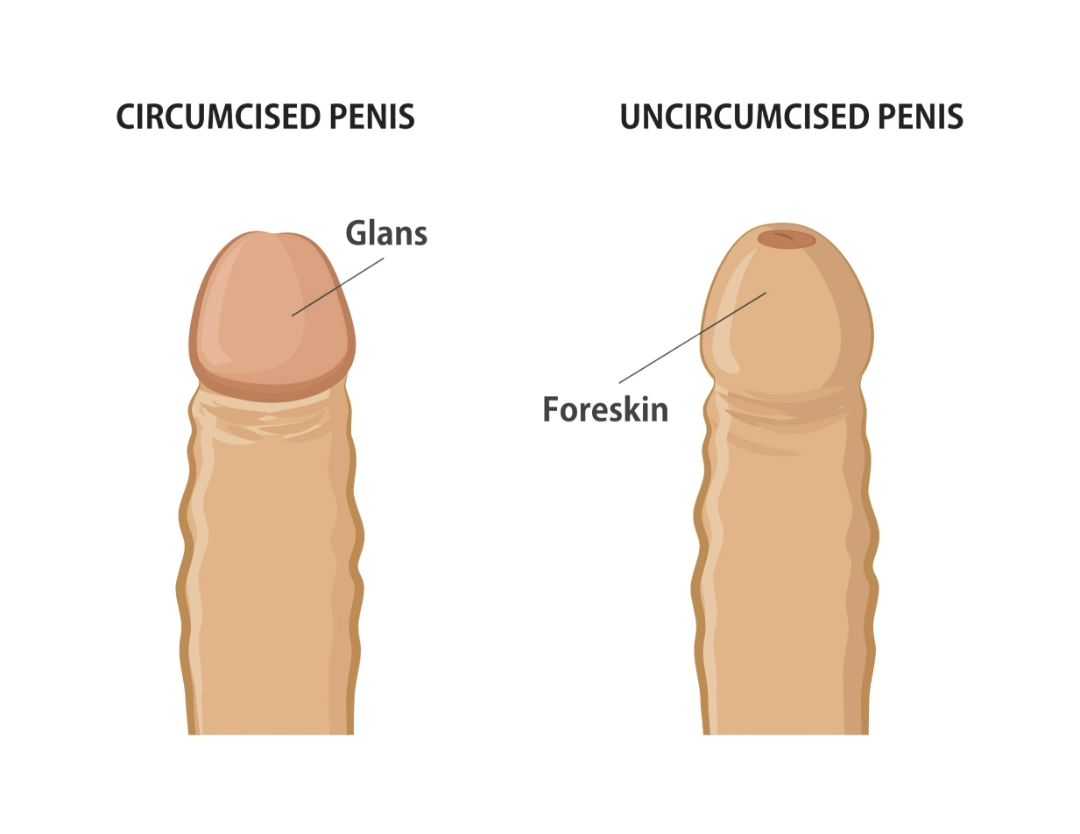 darian perkins recommends Uncircumsized Penis Sex
