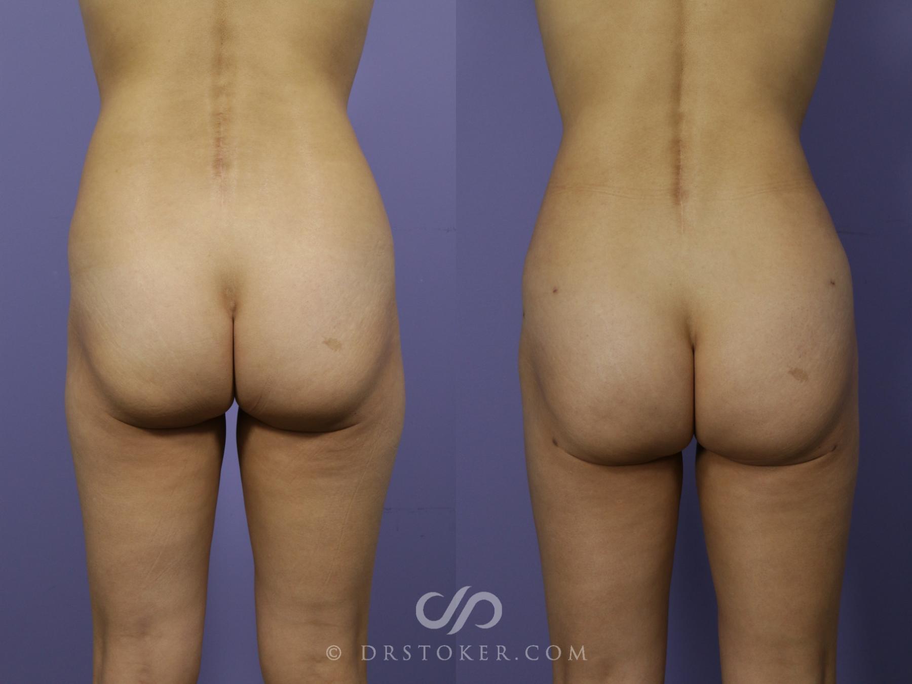 corina lugo like fat nude butt photo carolyn snively recommends fat nude butt pic