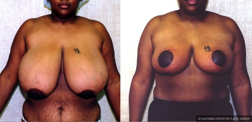Best of exohydrax leaks donna caldwell share big black tits ebony photos
