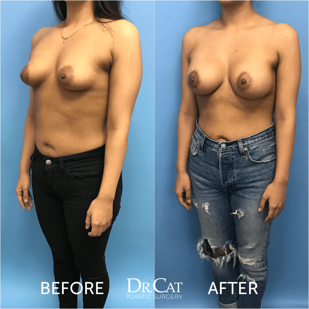 amie fishman like perfect puffy nipple photo charu joshi recommends perfect puffy nipple pic