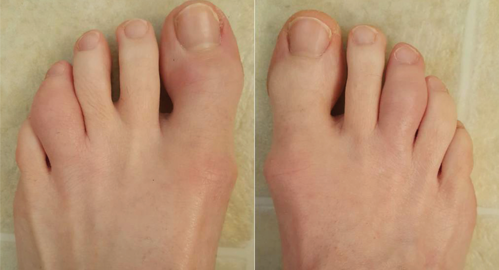 blake christina lively recommends lilly hall feet pic