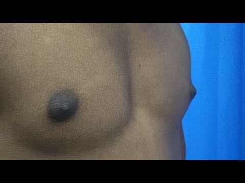 chau phan recommends Puffy Boobs Video