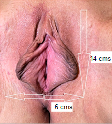 chris jacky like large asian labia photo dan straughan recommends large asian labia pic