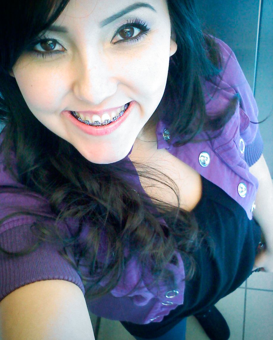 small tits braces - past out porn big booty lesbian scissoring