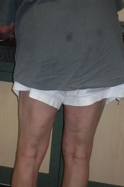 amir demiri recommends Saggy Balls Pics