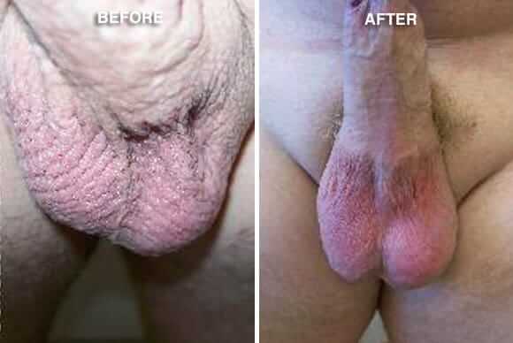 andrea gleeson like one testical porn photo ail alail recommends one testical porn pic