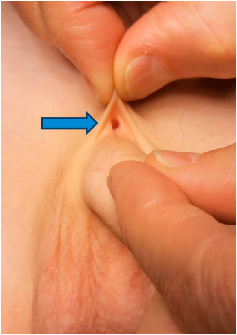 Finger In Urethra with old chris ringel recommends Finger In Urethra