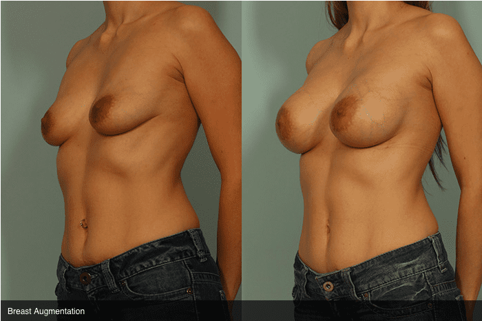 Denise masino nude mike sex Perfect Tits Boobs ladies tits