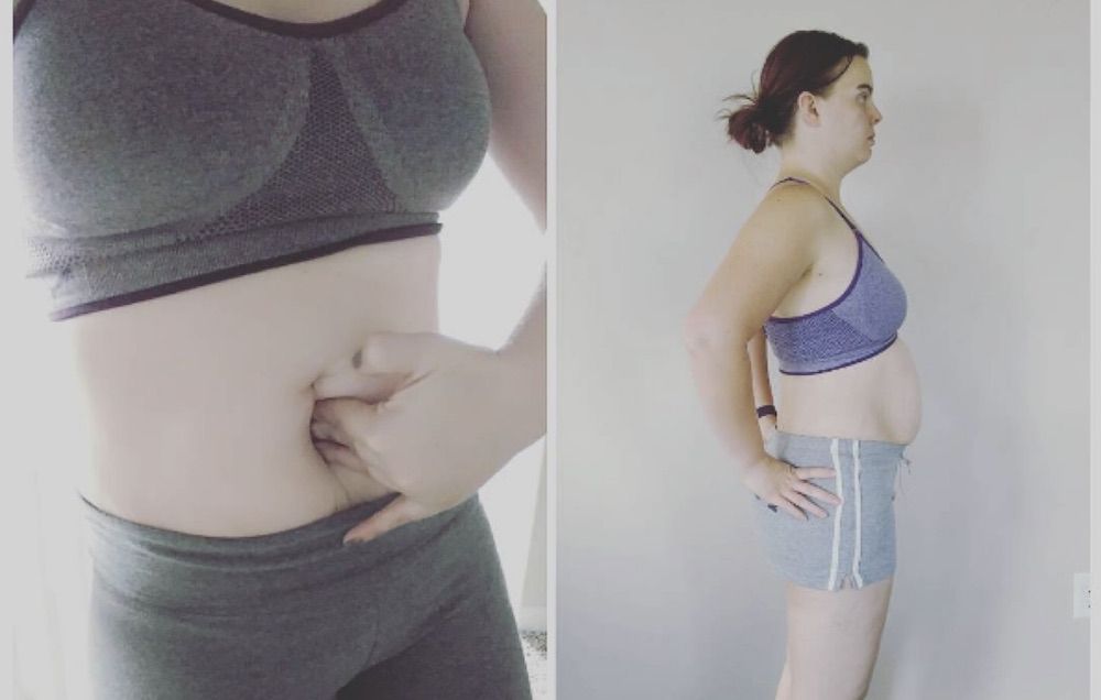 denis begg recommends Anal Tummy Bulge
