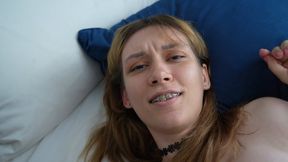 andrei custodio like braces and big tits photo alyssa blocker recommends braces and big tits pic