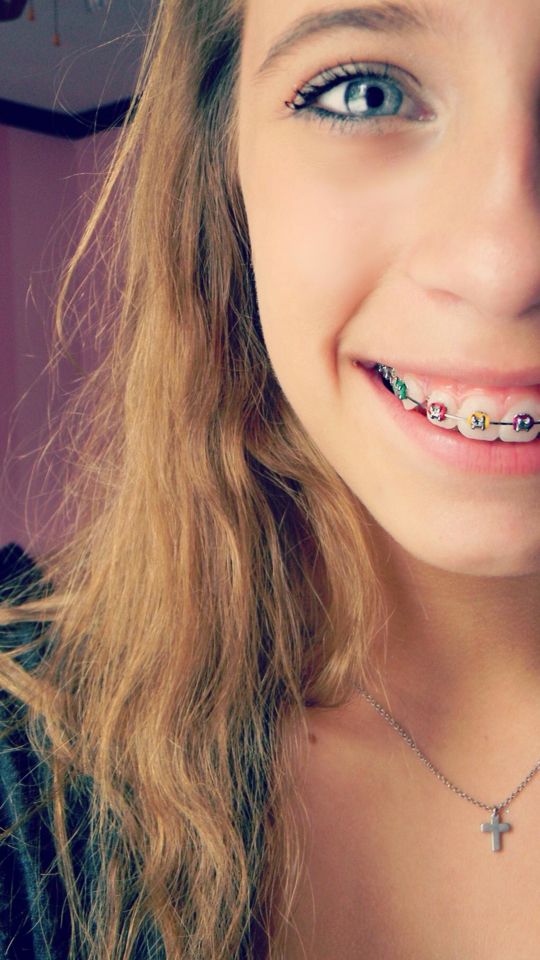 cum on braces comp - erotic smoking submissive interracial porn
