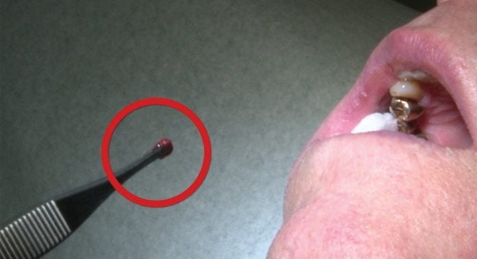 betty l roberts like finger in urethra photo aida li recommends finger in urethra pic