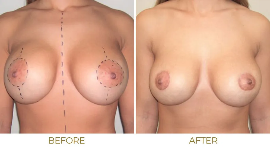 alison bird share 70 year old tits photos