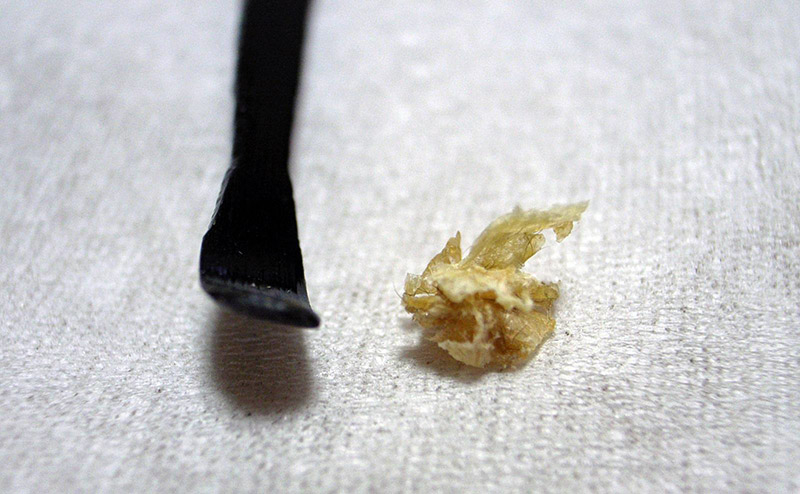 ear wax fetish abducted schoolgirl ear wax fetish