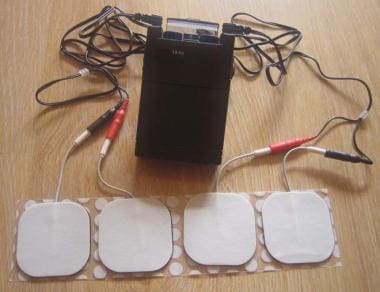 bonnie golliher recommends electrostimulation torture pic