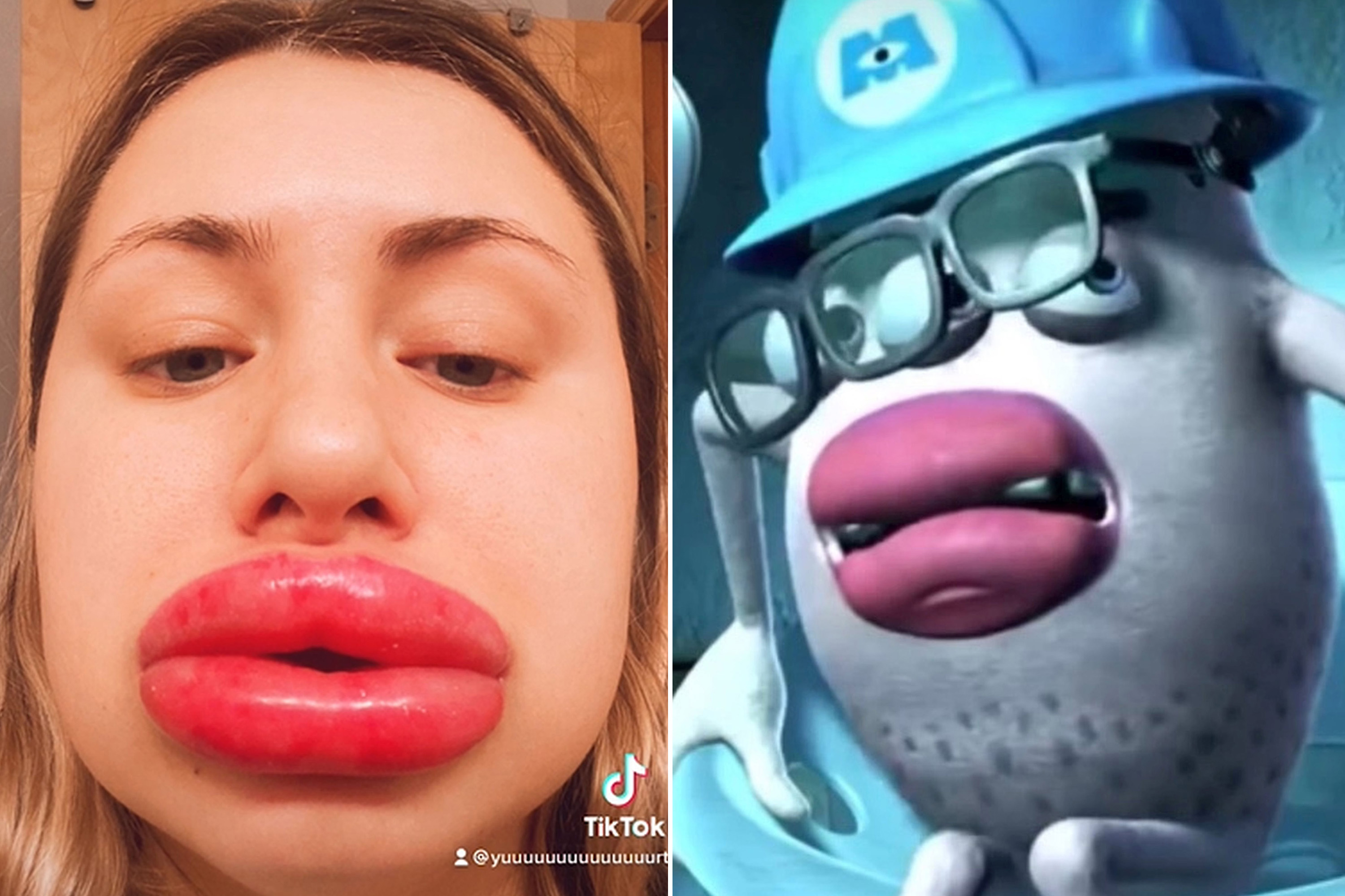 alec spaulding like fake lips porn photo carrie brightwell recommends fake lips porn pic