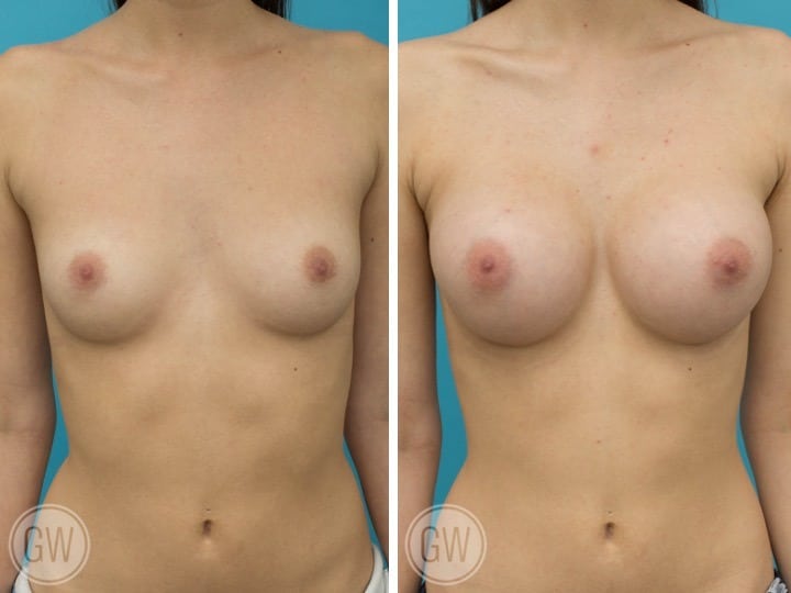 allyson fowler like perfect boobs solo photo allan w houston recommends perfect boobs solo pic