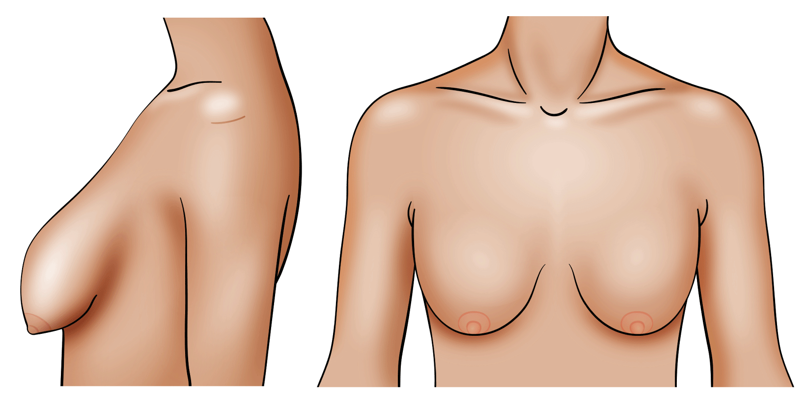 debbie schubert recommends Moms Saggy Titties