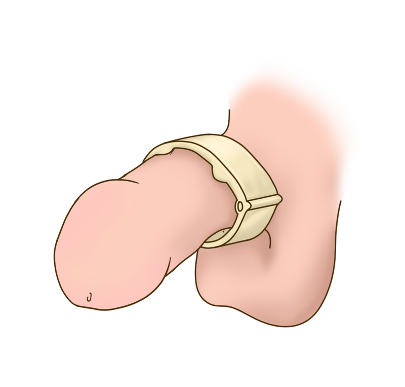 alee syed recommends Finger In Urethra