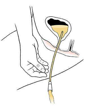 darren lamport recommends finger in urethra colleen lahndt add finger in urethra photo
