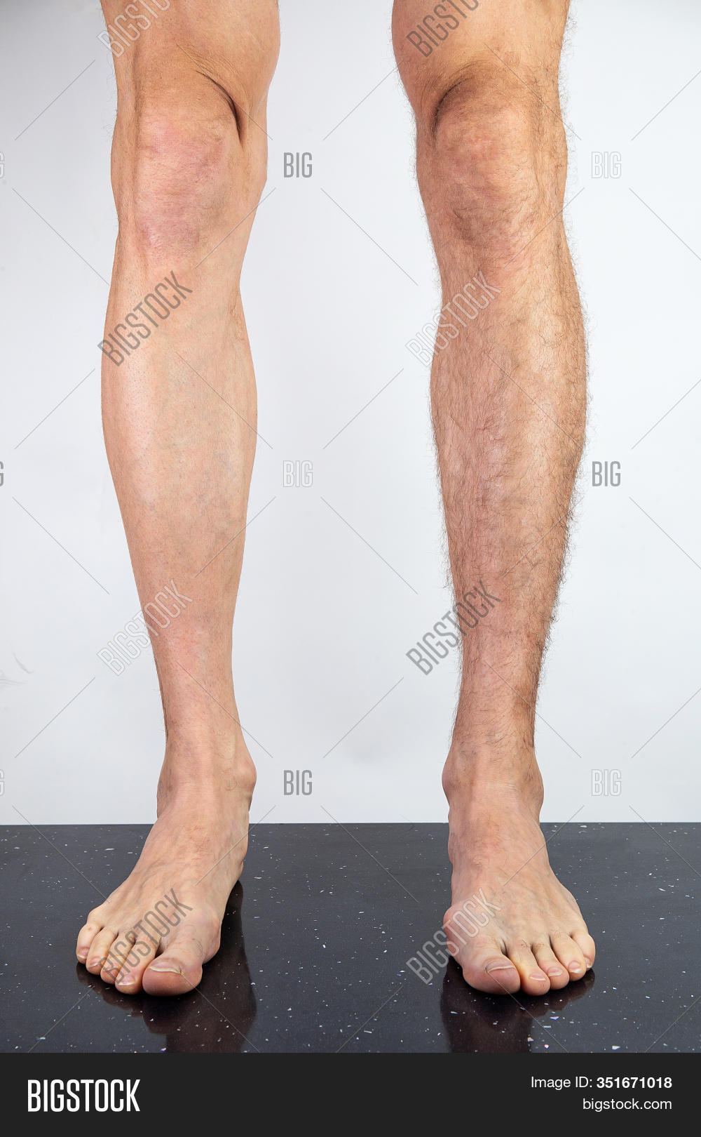 Best of lina belfiore leak chai hooi share hairy male legs pics photos