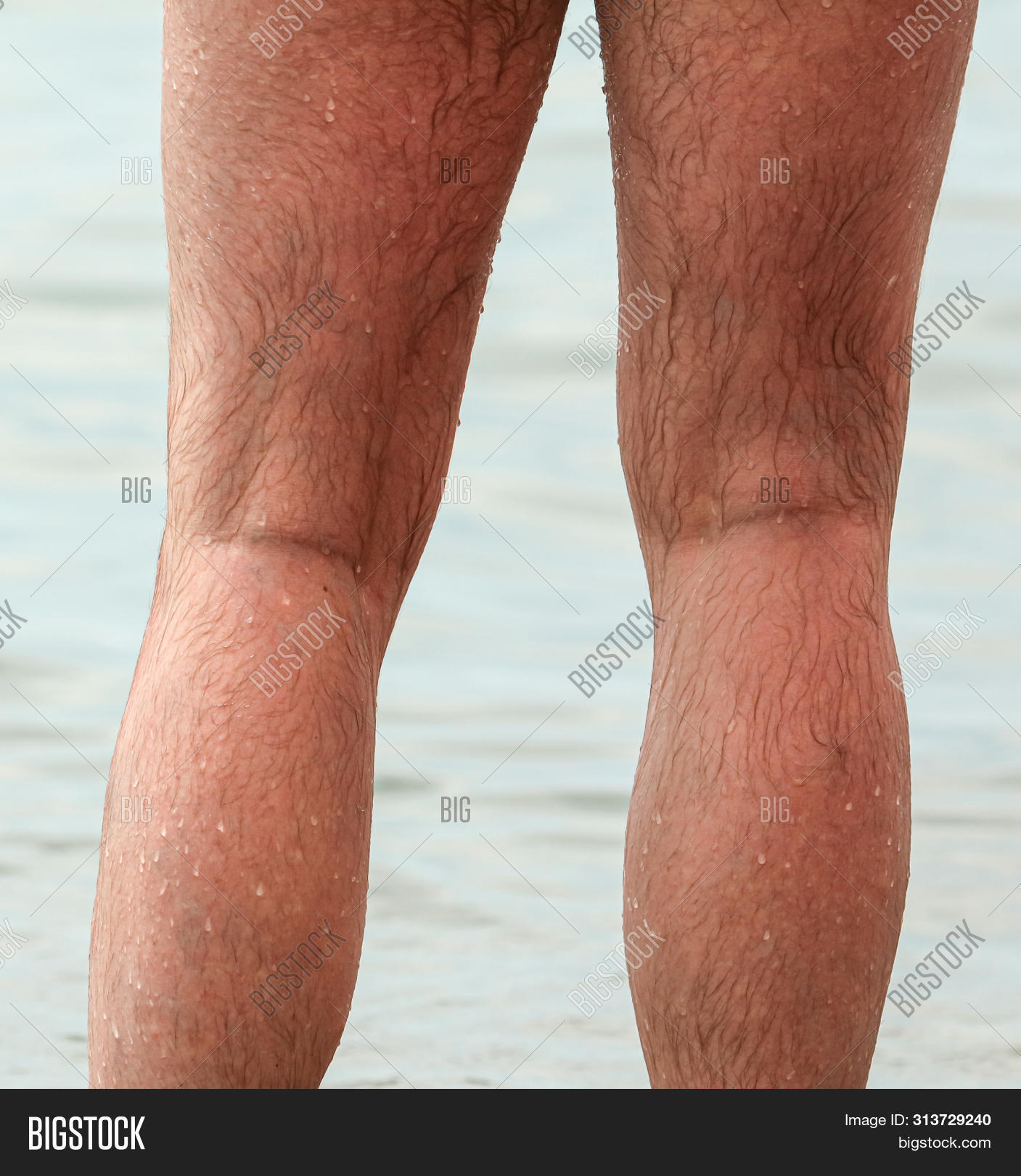 Best of Hairy male legs pics