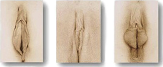 bryce bohannon recommends large asian labia dave jasinski add large asian labia photo