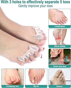 apurba mitra like loes toes photo bear mody recommends loes toes pic