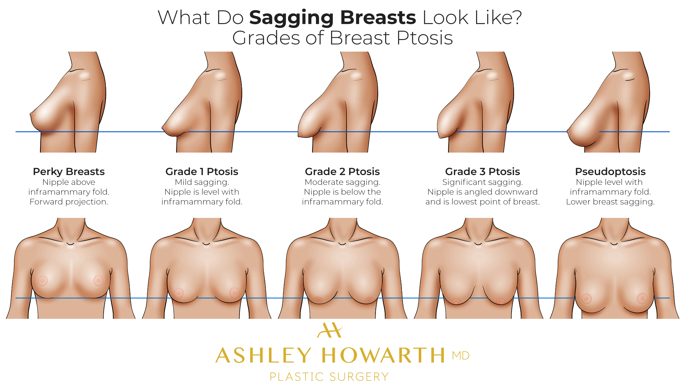 charmaine de vera recommends long saggy tits video brandin foster add long saggy tits video photo