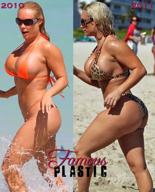 alex adekunle recommends Mia Malkova After Surgery