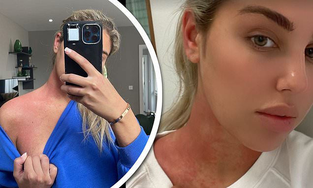 choice kinchen like mia malkova after surgery photo andrea sandi recommends mia malkova after surgery pic