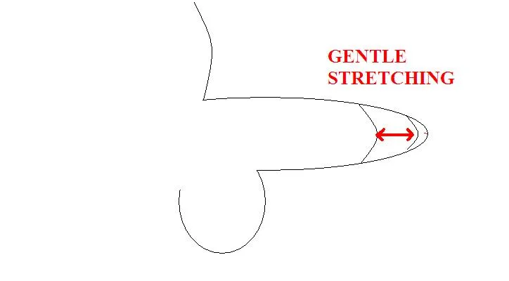 don steinman like porn phimosis photo ashraf wagih recommends thick ebony squirt pic