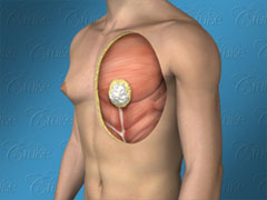allison barley recommends puffy boobs video pic