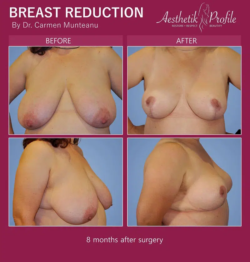puffy breast video forum thaimassageguiden puffy breast video