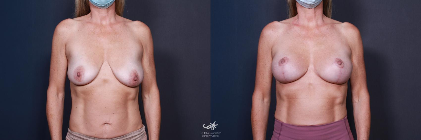 teens with big saggy tits einer rothaarigen teens with big saggy tits